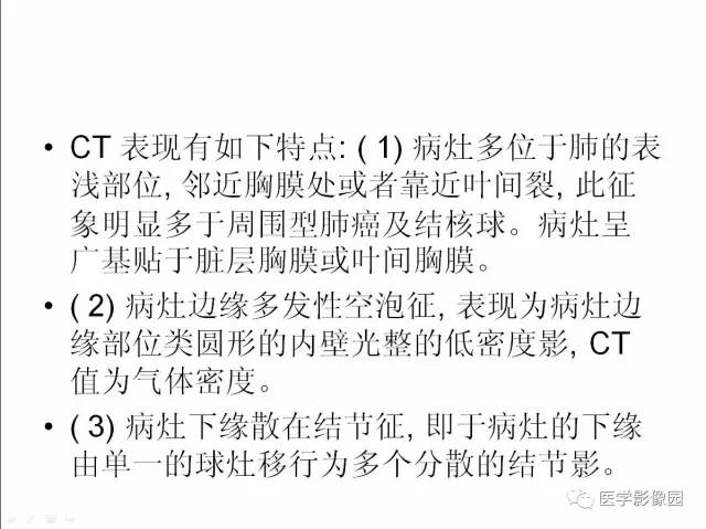 【病例】肺部炎性假瘤1例CT影像表现