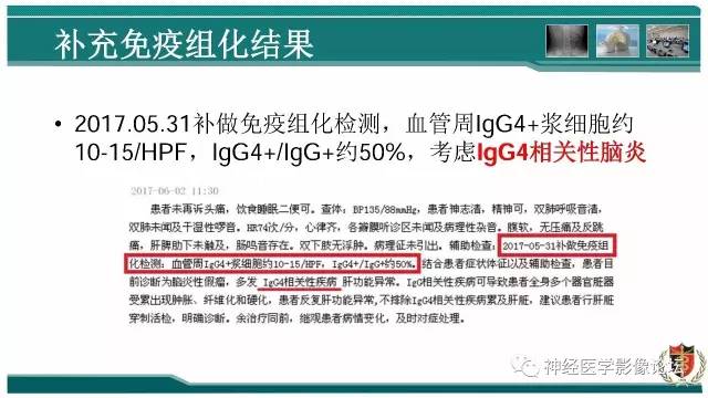 【病例】难得一见的IgG4脑炎MR