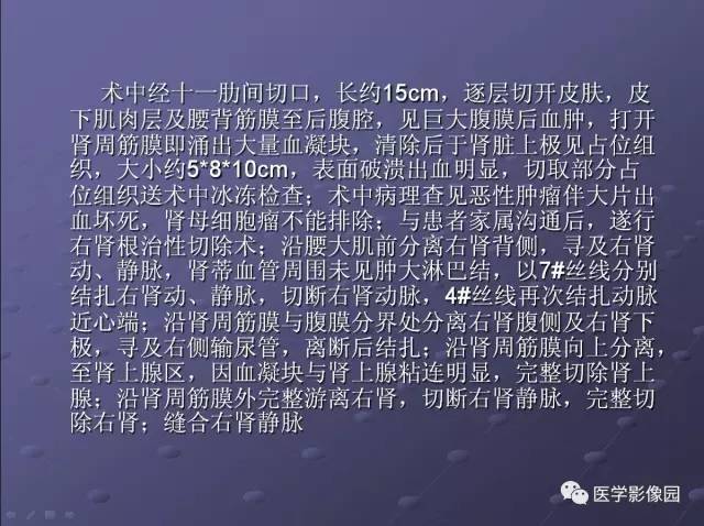 【病例】肾母细胞瘤1例CT影像表现
