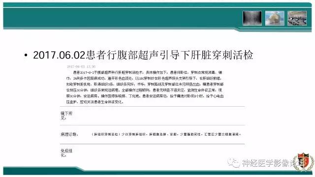 【病例】难得一见的IgG4脑炎MR