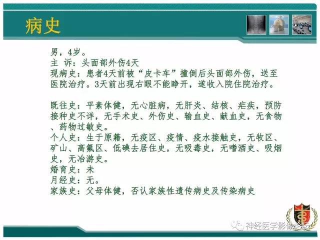 【病例】外伤后渗透性髓鞘溶解症一例MR