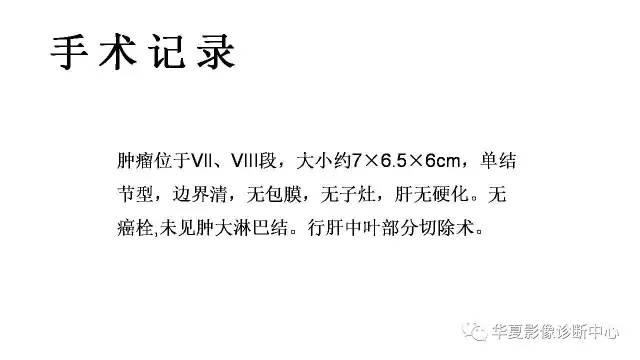 【病例】纤维板层型肝癌1例CT影像表现