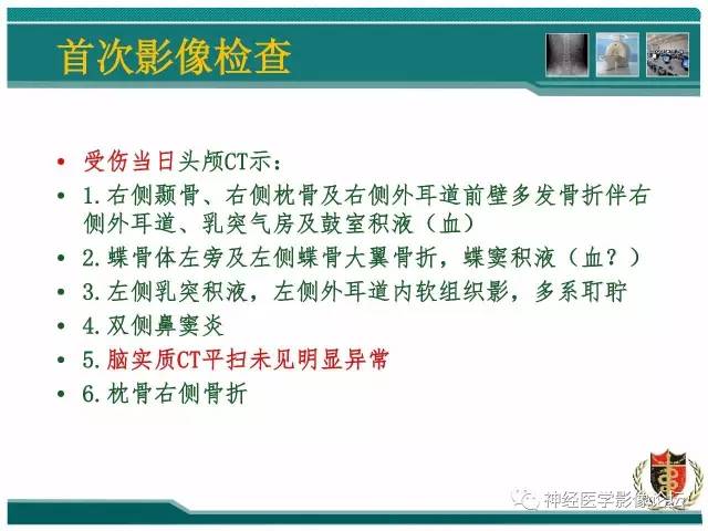 【病例】外伤后渗透性髓鞘溶解症一例MR 【病例】外伤后渗透性髓鞘溶解症一例MR
