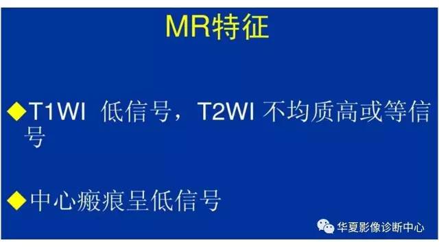 【病例】纤维板层型肝癌1例CT影像表现