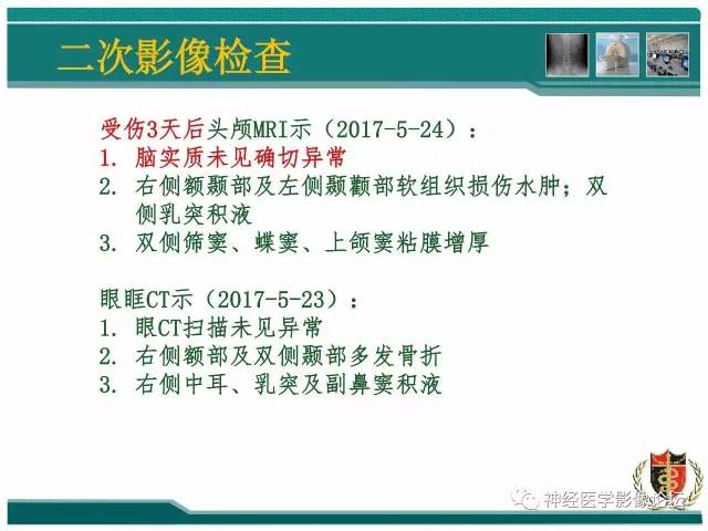 【病例】外伤后渗透性髓鞘溶解症一例MR 【病例】外伤后渗透性髓鞘溶解症一例MR