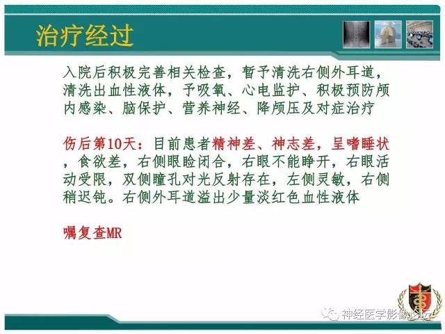 【病例】外伤后渗透性髓鞘溶解症一例MR 【病例】外伤后渗透性髓鞘溶解症一例MR