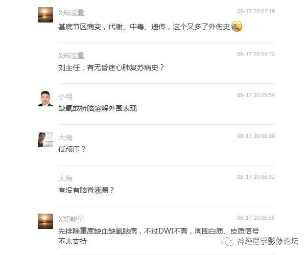 【病例】外伤后渗透性髓鞘溶解症一例MR 【病例】外伤后渗透性髓鞘溶解症一例MR