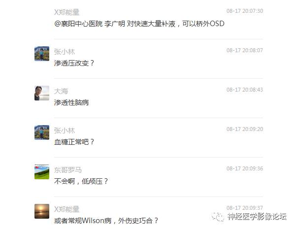 【病例】外伤后渗透性髓鞘溶解症一例MR 【病例】外伤后渗透性髓鞘溶解症一例MR
