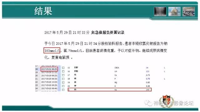 【病例】外伤后渗透性髓鞘溶解症一例MR 【病例】外伤后渗透性髓鞘溶解症一例MR