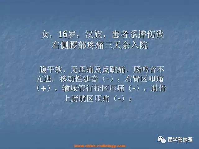 【病例】肾母细胞瘤1例CT影像表现