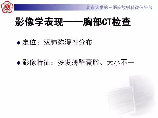 【病例】肺淋巴管肌瘤病1例CT影像表现