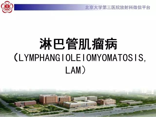 【病例】肺淋巴管肌瘤病1例CT影像表现