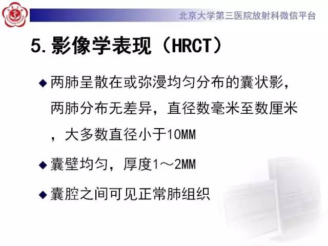 【病例】肺淋巴管肌瘤病1例CT影像表现