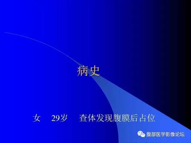 【病例】肾上腺节细胞神经纤维瘤1例CT及MR