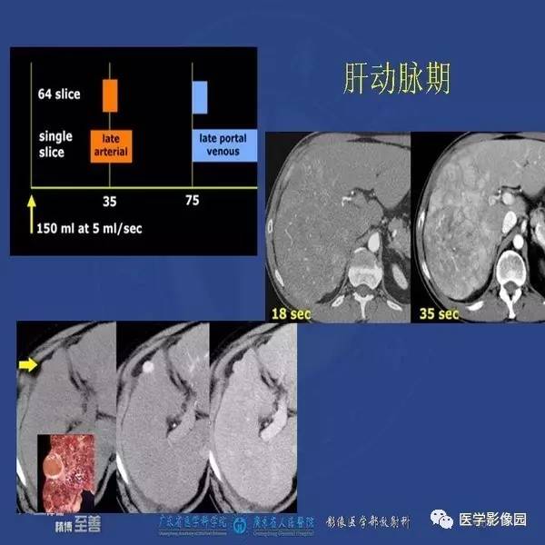 【PPT】解读碘对比剂使用指南V2