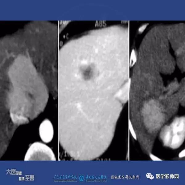 【PPT】解读碘对比剂使用指南V2