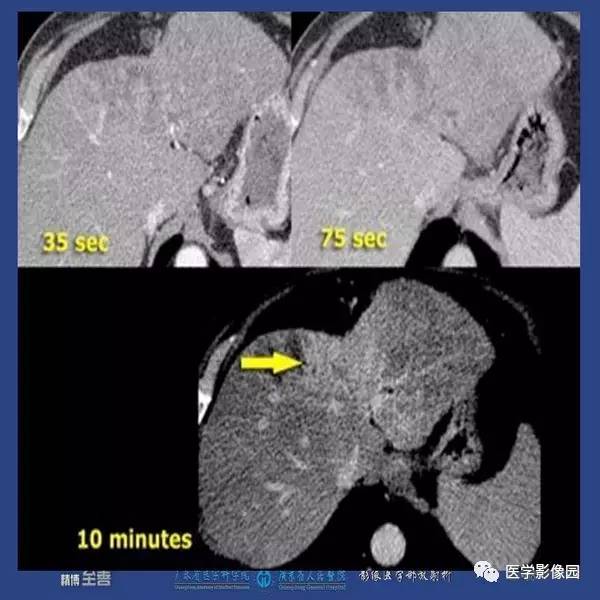 【PPT】解读碘对比剂使用指南V2