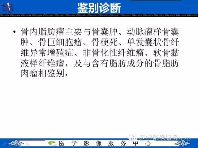 【影像征象】帽徽征——骨脂肪瘤