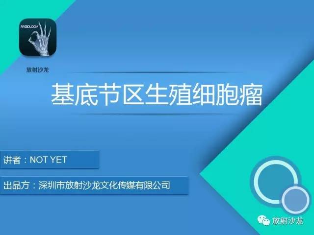 【病例】基底节区生殖细胞瘤1例MR影像表现