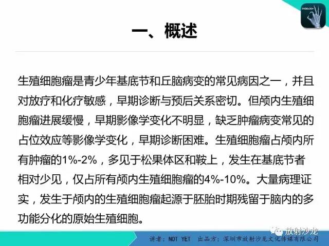【病例】基底节区生殖细胞瘤1例MR影像表现