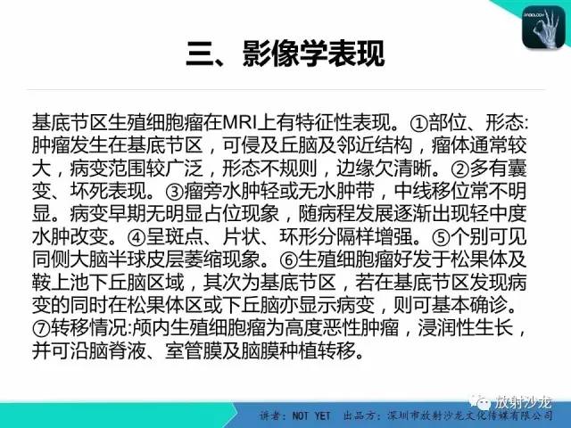 【病例】基底节区生殖细胞瘤1例MR影像表现