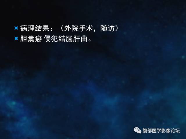 【病例】胆囊癌侵犯结肠肝曲1例CT 【病例】胆囊癌侵犯结肠肝曲1例CT
