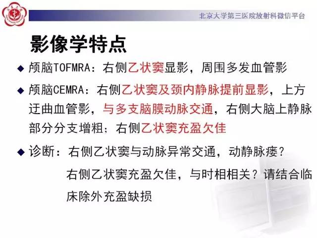 【病例】硬脑膜动静脉瘘1例MR影像表现