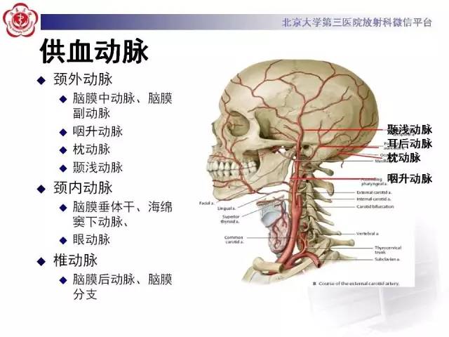 【病例】硬脑膜动静脉瘘1例MR影像表现