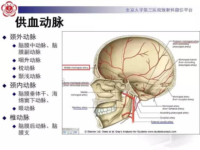 【病例】硬脑膜动静脉瘘1例MR影像表现