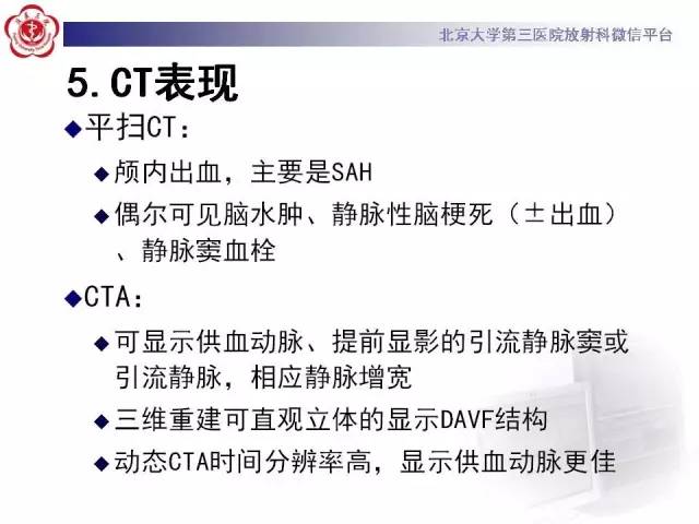 【病例】硬脑膜动静脉瘘1例MR影像表现