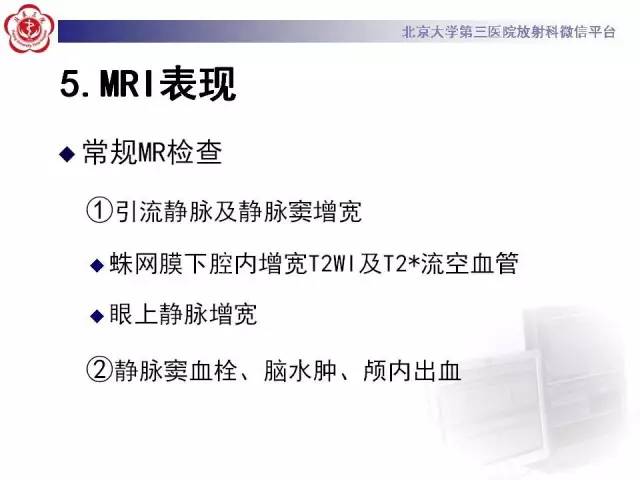 【病例】硬脑膜动静脉瘘1例MR影像表现
