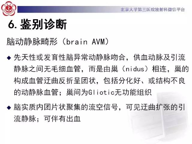 【病例】硬脑膜动静脉瘘1例MR影像表现