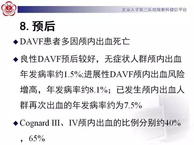 【病例】硬脑膜动静脉瘘1例MR影像表现