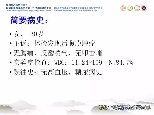 【病例】腹膜后巨淋巴结增生症1例CT