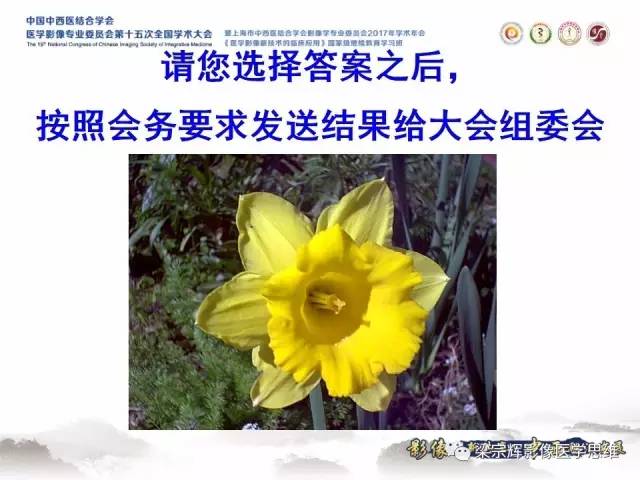 【病例】腹膜后巨淋巴结增生症1例CT