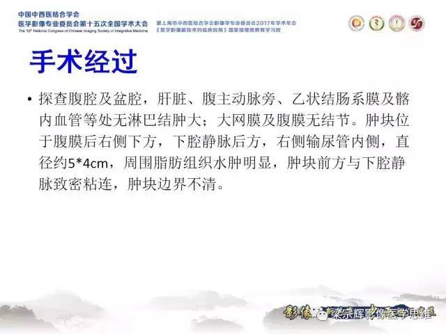 【病例】腹膜后巨淋巴结增生症1例CT