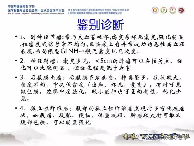 【病例】腹膜后巨淋巴结增生症1例CT