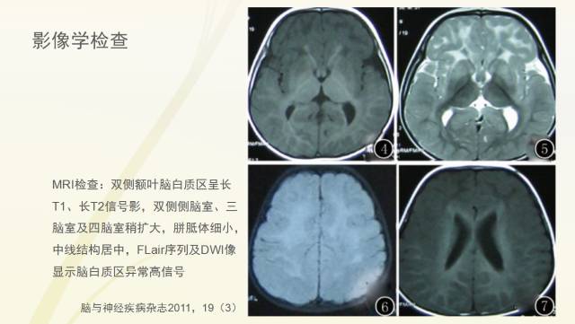 自动草稿