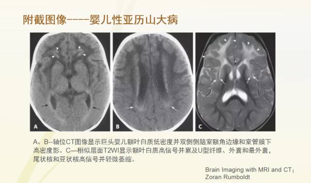 自动草稿