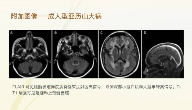 自动草稿