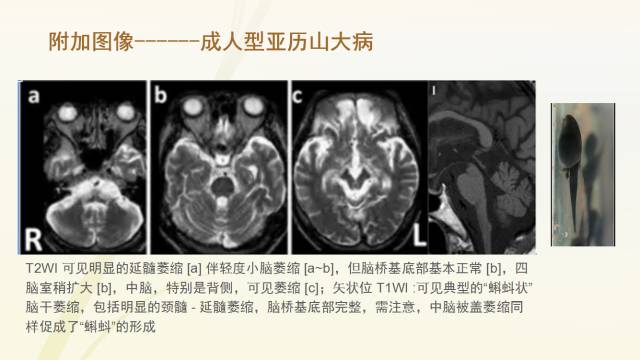 自动草稿