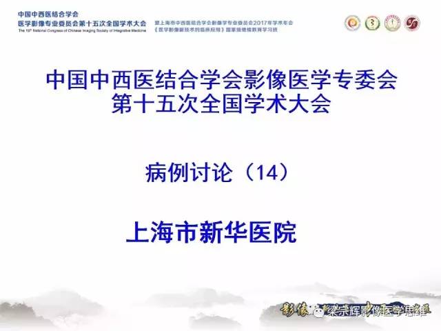 【病例】腹膜后囊腺癌1例CT