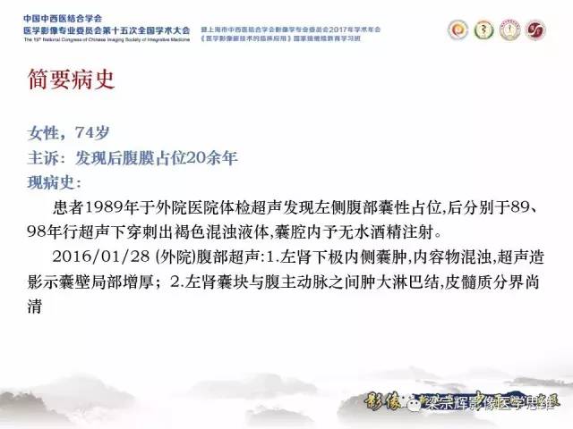 【病例】腹膜后囊腺癌1例CT