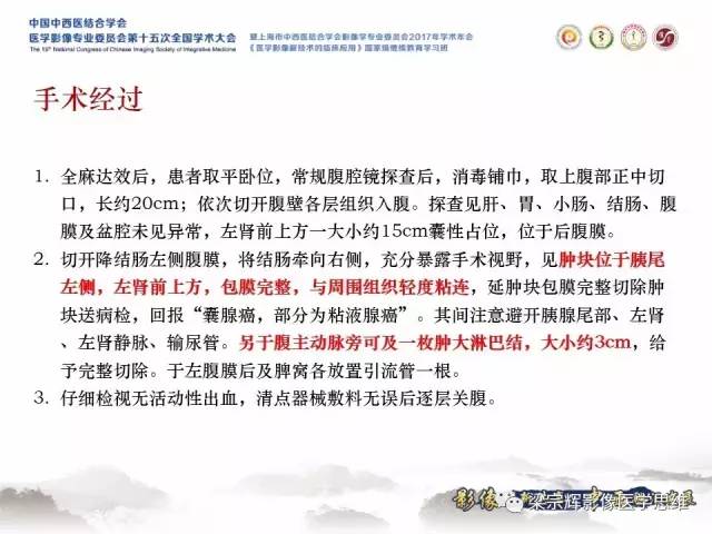 【病例】腹膜后囊腺癌1例CT