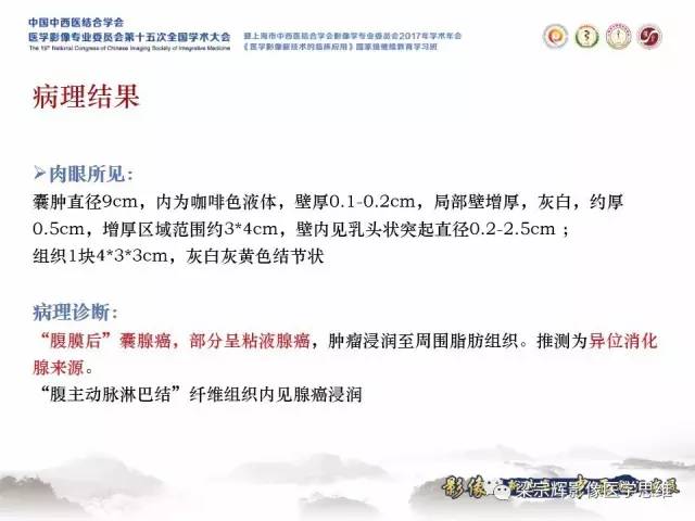 【病例】腹膜后囊腺癌1例CT