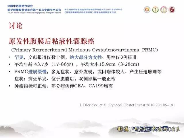 【病例】腹膜后囊腺癌1例CT
