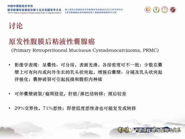 【病例】腹膜后囊腺癌1例CT