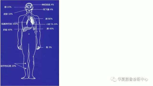 【病例】结节病1例CT影像表现