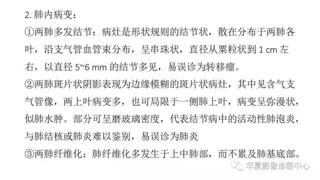 【病例】结节病1例CT影像表现