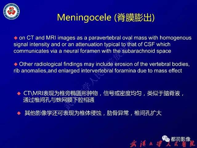 【PPT】纵隔囊性及囊样病变影像学诊断
